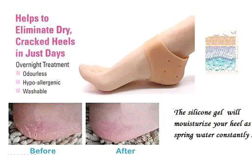 Half Heel Socks For Foot Care, Pain Relief & Heel Cracks- 1 Pair (Free Size)